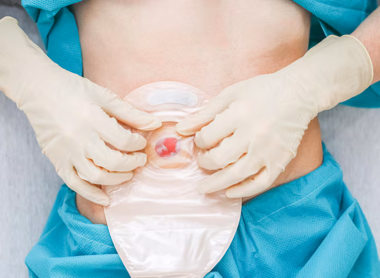 Antenatal Care